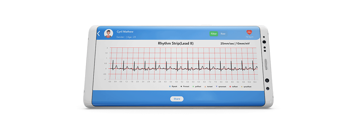 Filtered ECG Signal